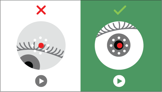 The red dot should be over the patient’s pupil. The background will turn green when the camera is aligned.