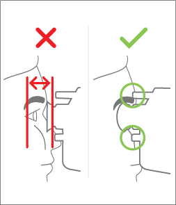 Seat device comfortably on patient’s face. Both contact points should touch face. Eyecup should cover orbit of the eye.