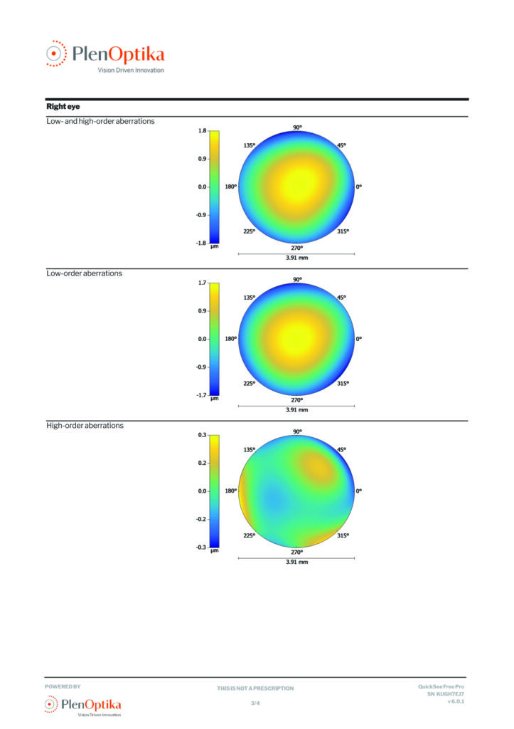 patient report printout wavefront page