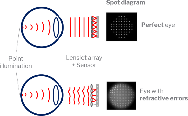 Diagrams of wavefront aberrometry spot diagrams in perfect eyes and eyes with refractive error