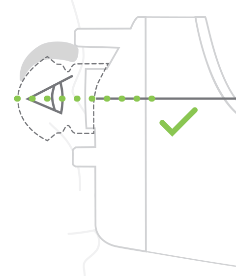 Illustration showing how line on the side of the device should be level with the patient's lateral canthus.