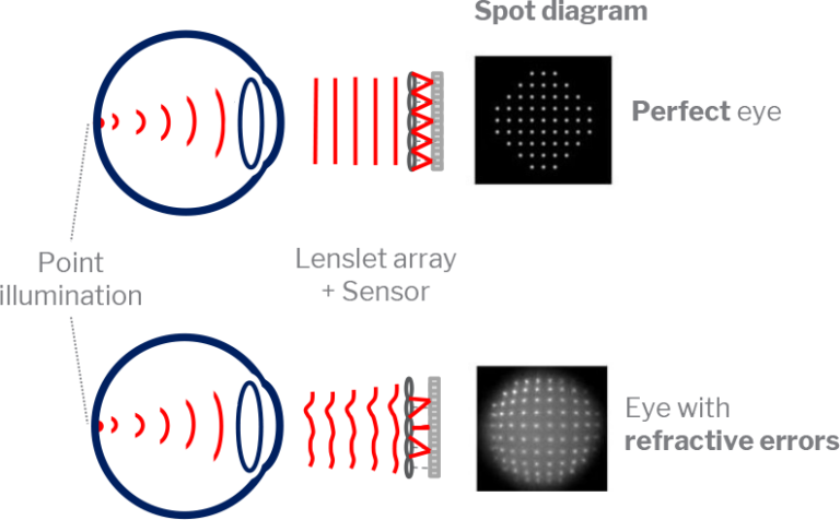 Wavefront Auto Refractor How wavefront aberrometry improves autorefraction | PlenOptika: Vision ...